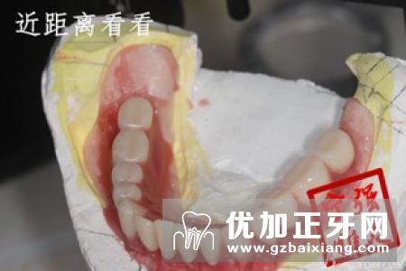 上颌第一磨牙解剖(图)