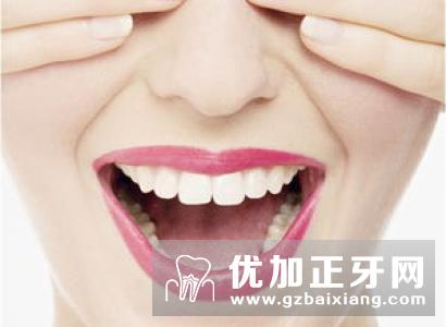 烤瓷牙为一些不完美的牙齿提供了梦幻般的治疗效果