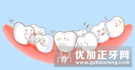 牙齿白就代表口腔健康吗？