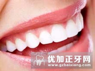 氟斑牙能美白吗,氟斑牙能治愈吗?