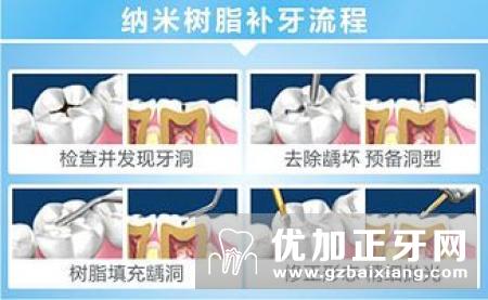 口腔修复的基本过程