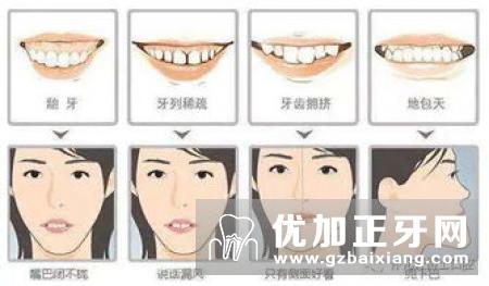 全瓷牙矫正牙齿 假牙也能矫正