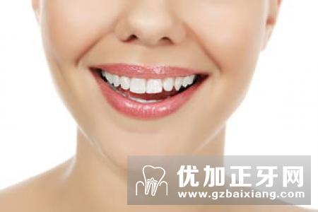 氟斑牙美白修复的方法有哪些