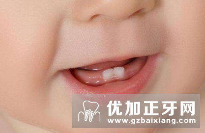 宝宝牙齿护理很重要,学这几招让宝宝一口健康白牙